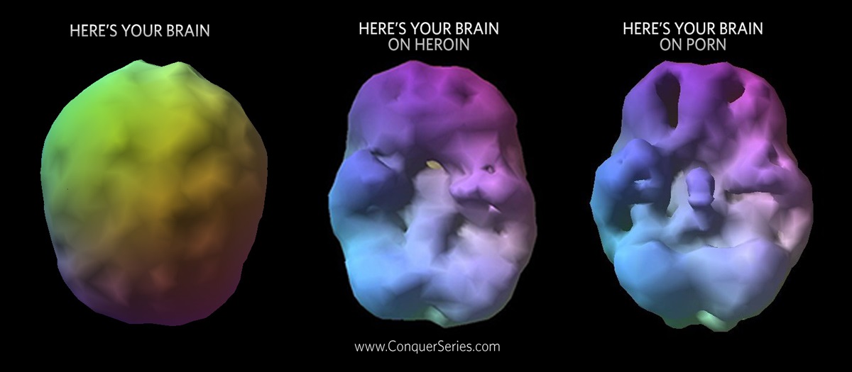 Your Brain on Porn