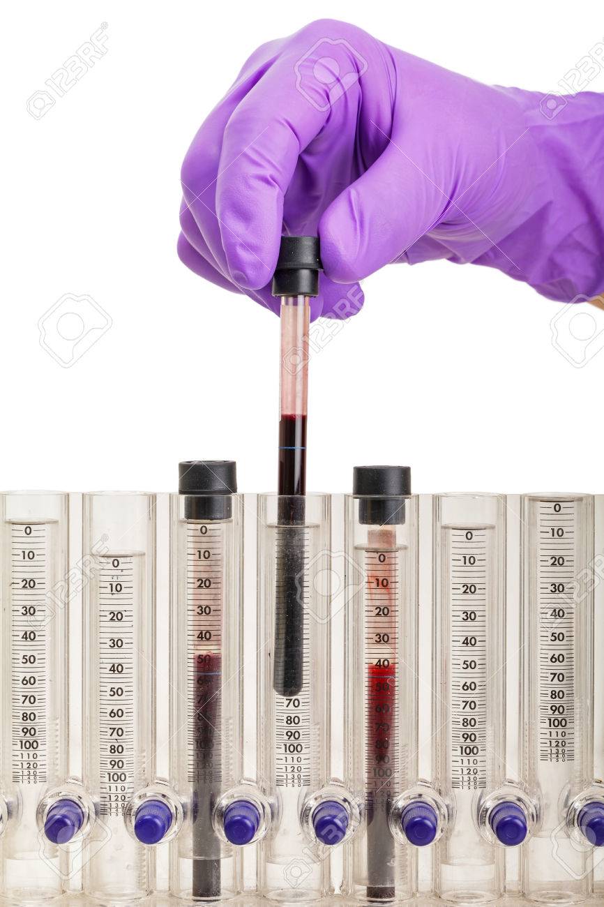 Photo Of Blood Sample Tubes In Young Doctor Hand For Erythrocyte ...