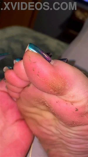 Watch Extremely stinky toejam feet - Sweaty Feet, Foot Fetish ...