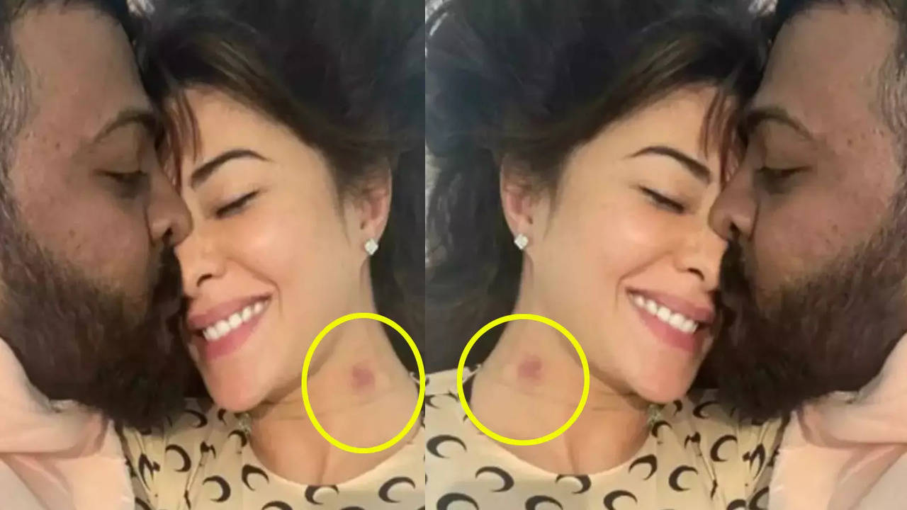 Jacqueline Fernandez flaunts her love bite in this latest leaked ...