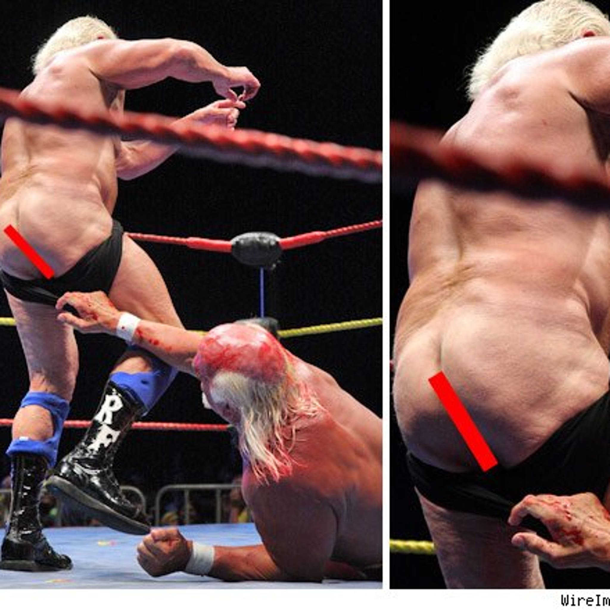 Hulk Hogan Hits Bottom