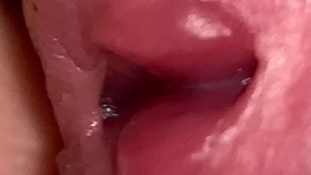 Urethral Examination - Pornhub.com