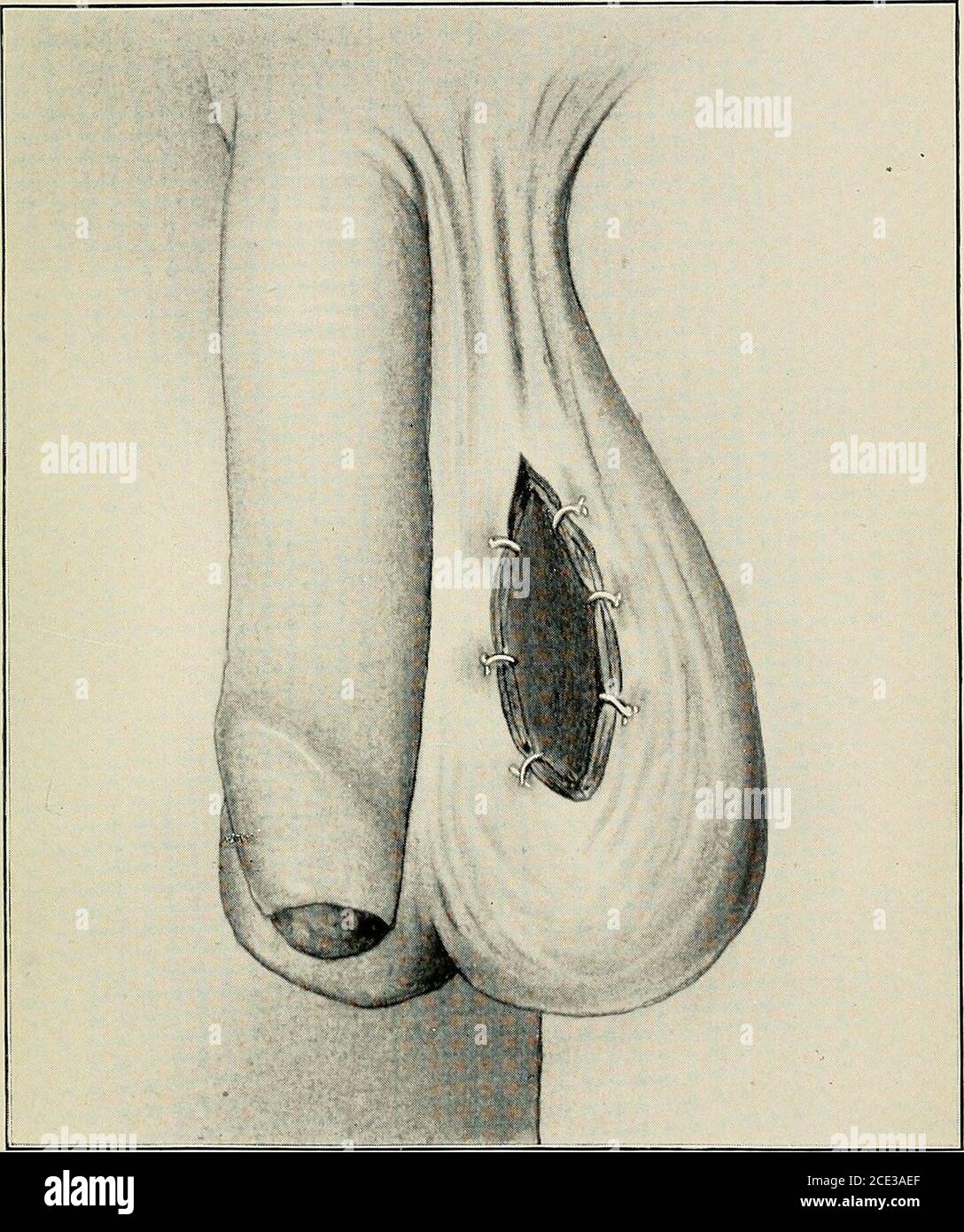 Operative surgery, for students and practitioners . y, but the ...