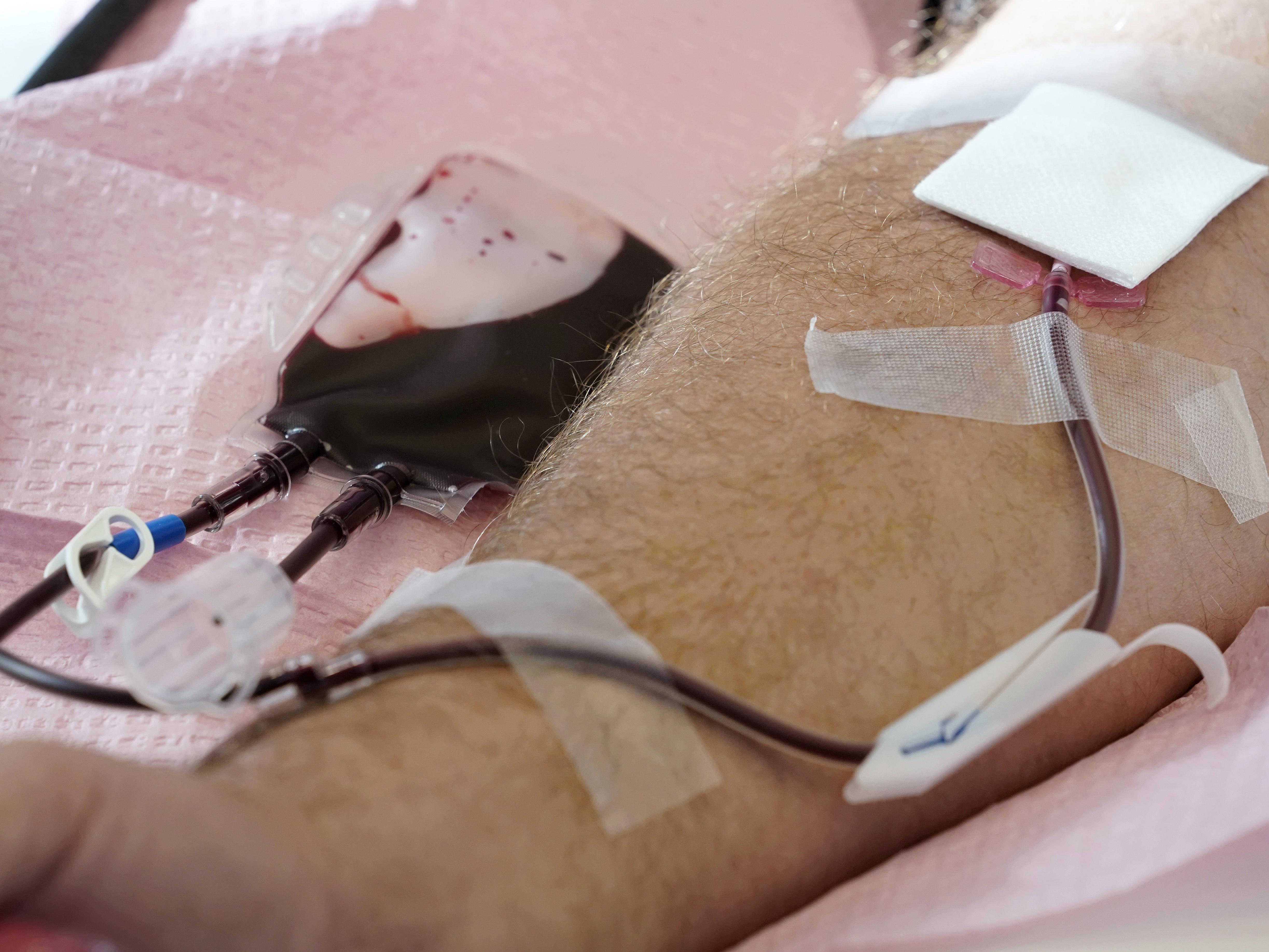 FDA Changes Blood Donor Eligibility for Gay, Bisexual Men | The ...