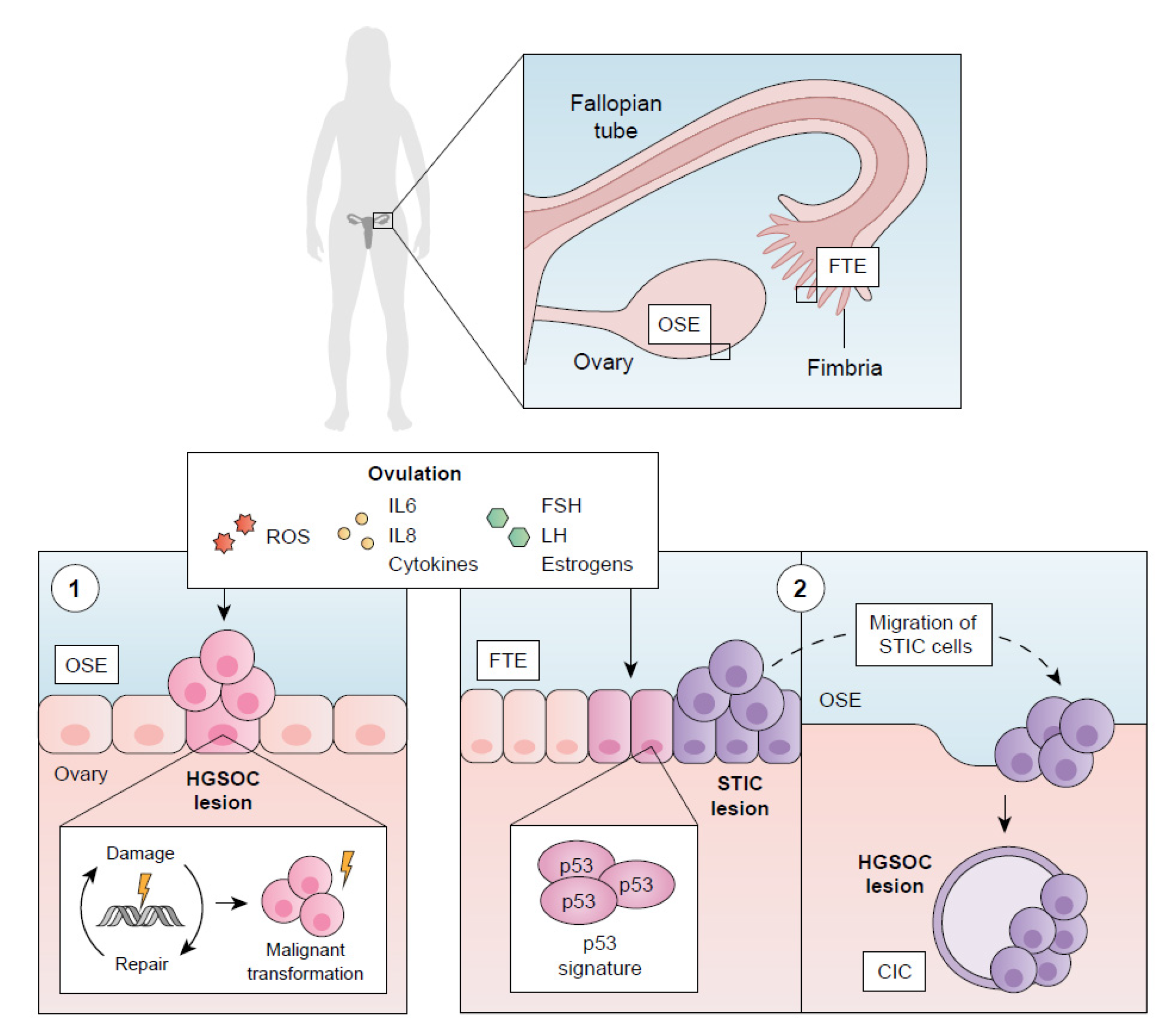 IJMS | Free Full-Text | Molecular Management of High-Grade Serous ...