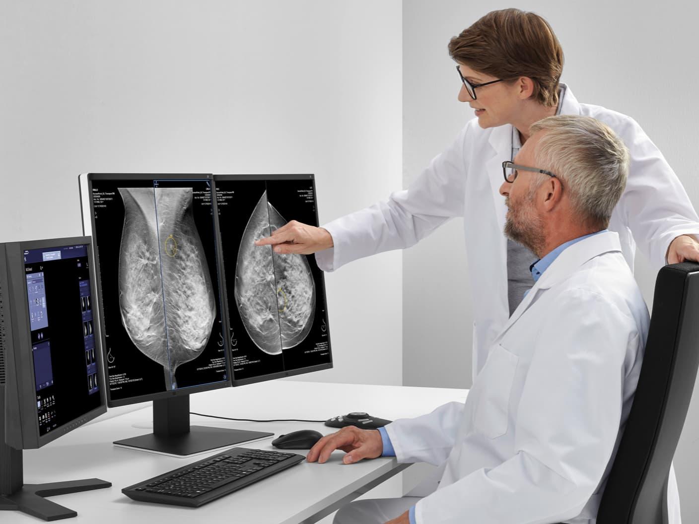 High Definition Breast Tomosynthesis - Siemens Healthineers USA