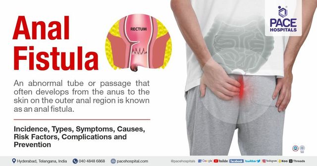 Anal fistula - Symptoms, Causes, Types, Complications, Prevention