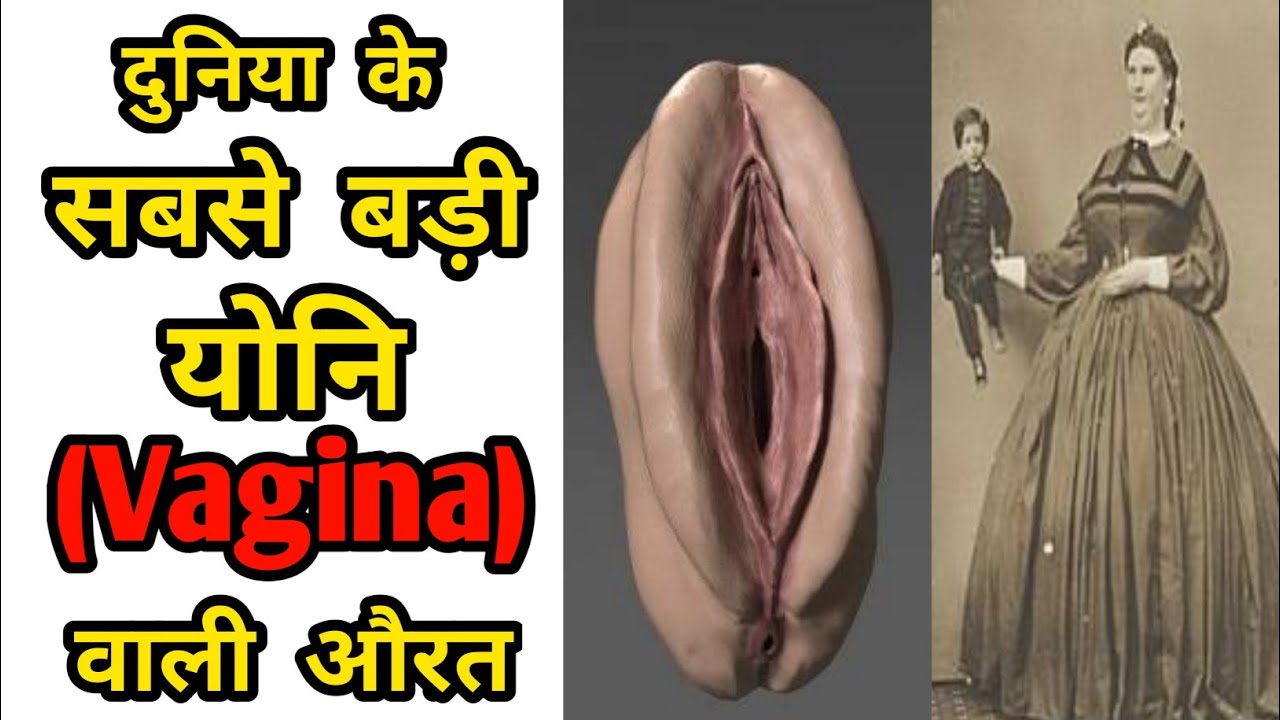 दुनिया की सबसे बड़ी योनि 😱 | World's Biggest ...