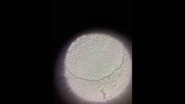 Watching Sperm with a Microscope(x500)! - Pornhub.com