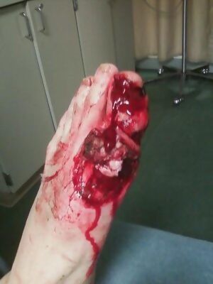 gore accident Porn Pics and XXX Videos - Reddit NSFW