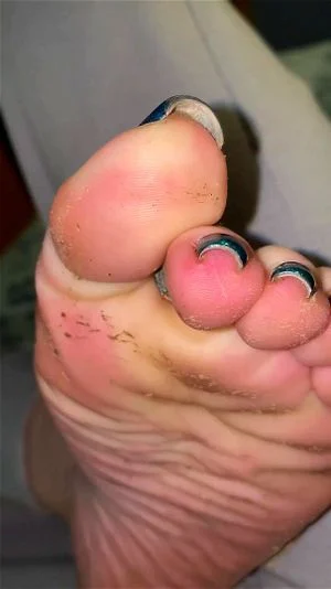 Watch Extremely stinky toejam feet - Sweaty Feet, Foot Fetish ...