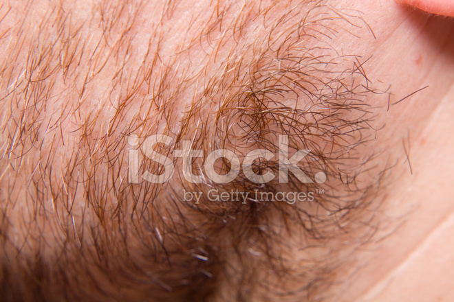 Stubbly Chin Macro Xxxl Stock Photo | Royalty-Free | FreeImages