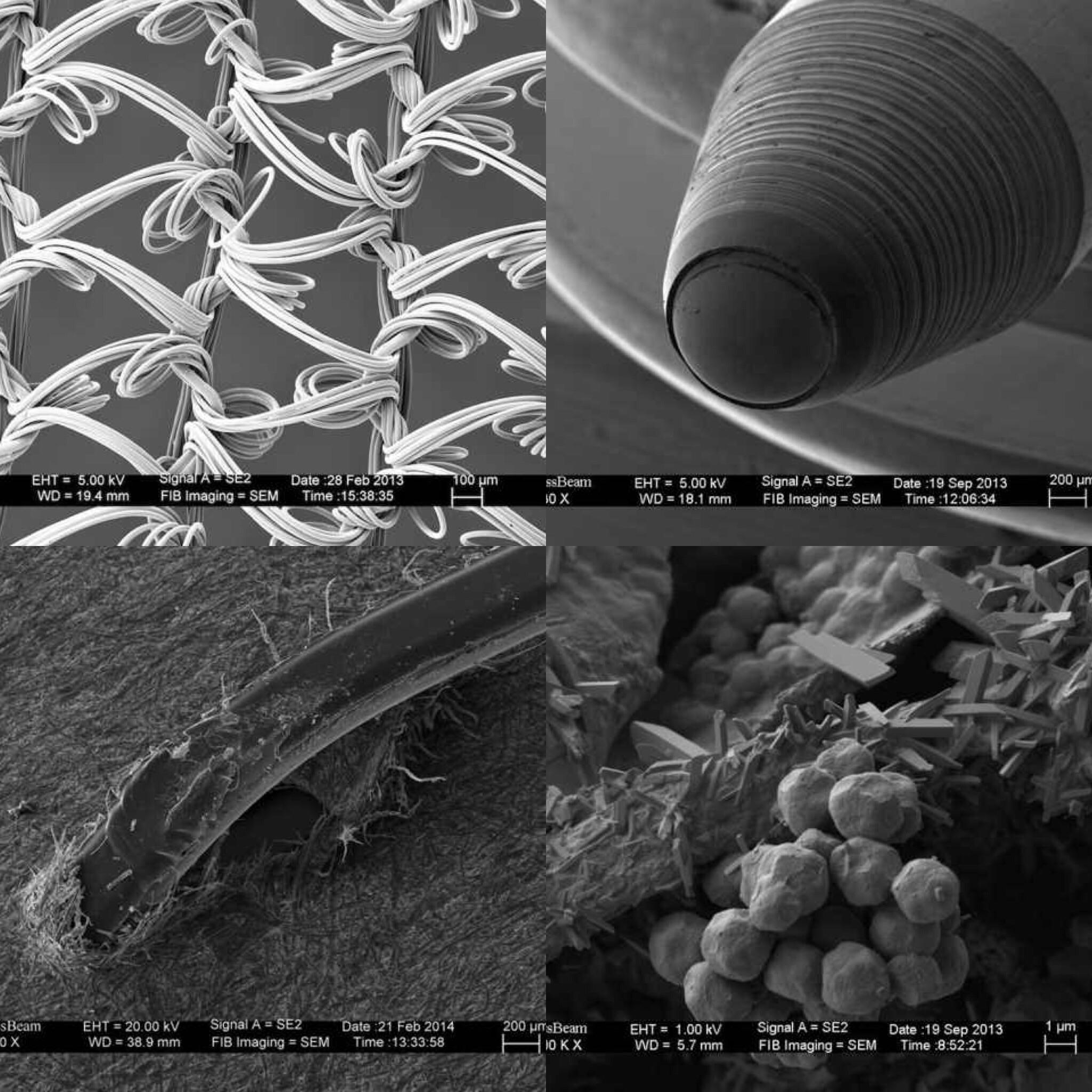 Keeping with the theme of things under an electron microscope... I ...