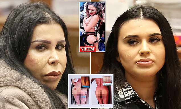 California court is shown horrific photo of exploded BUTT as mom ...