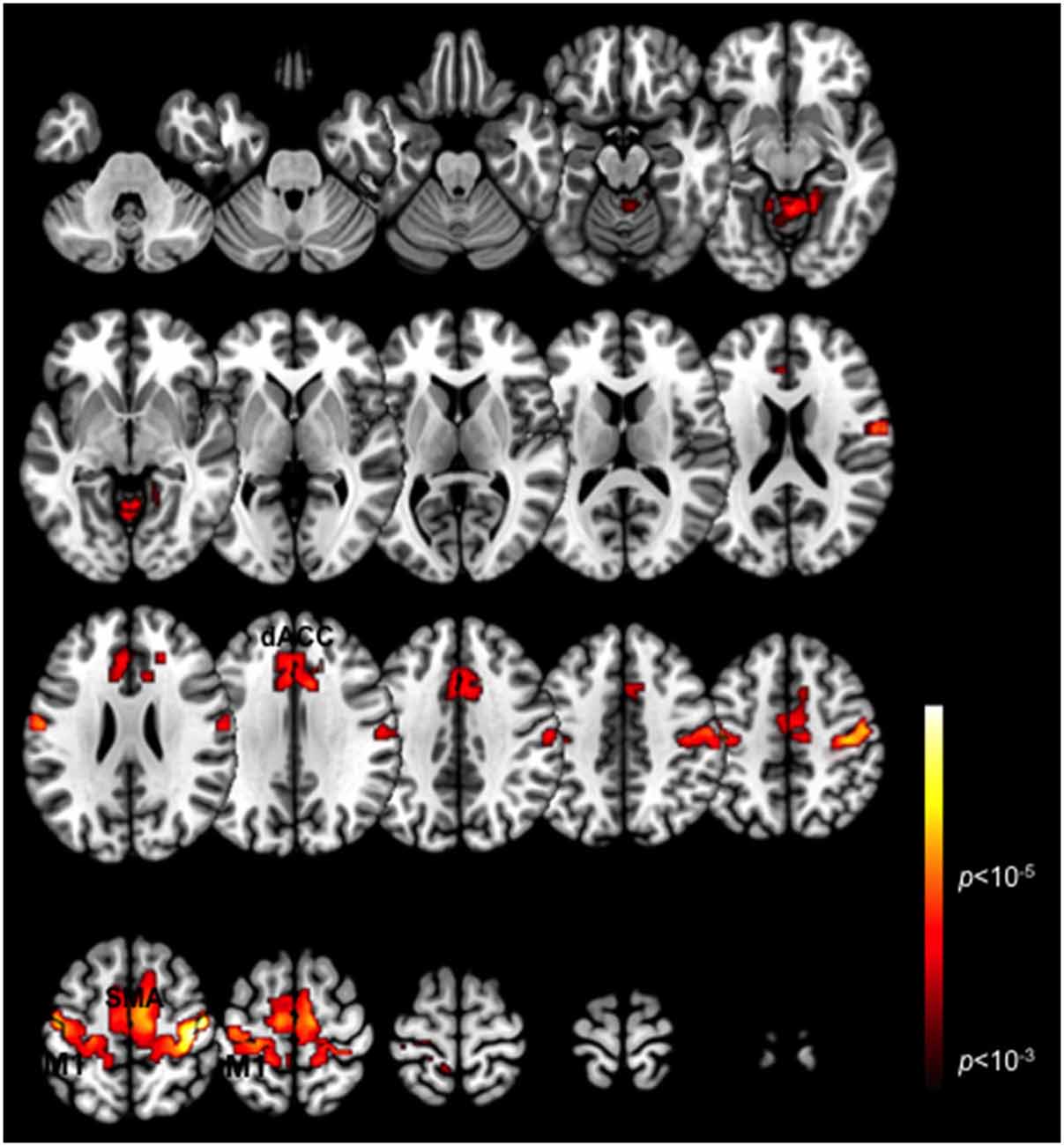 Frontiers | Dorsal anterior cingulate cortex modulates ...