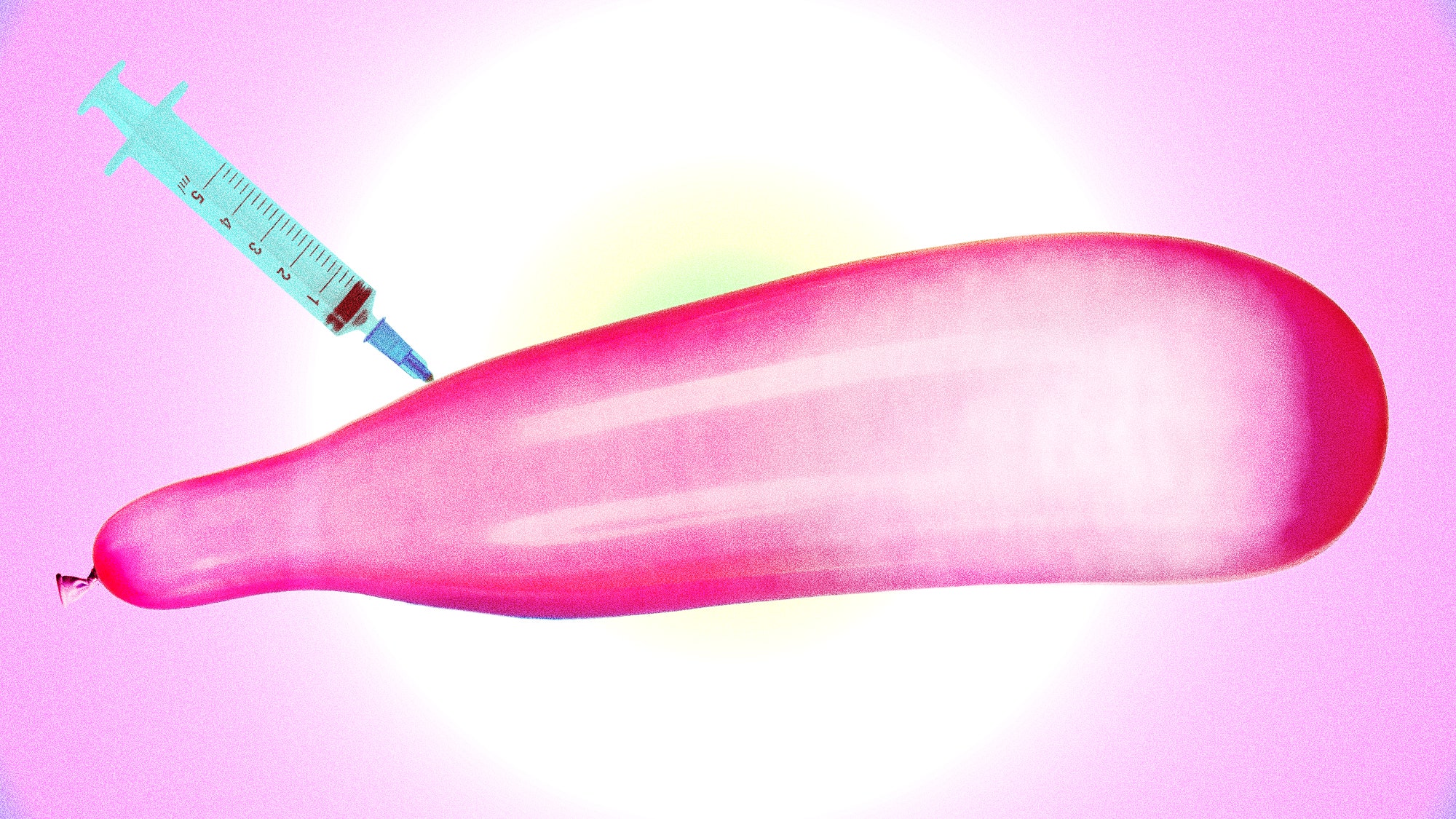 How Injectable Fillers Became the Biggest Thing in Penis ...